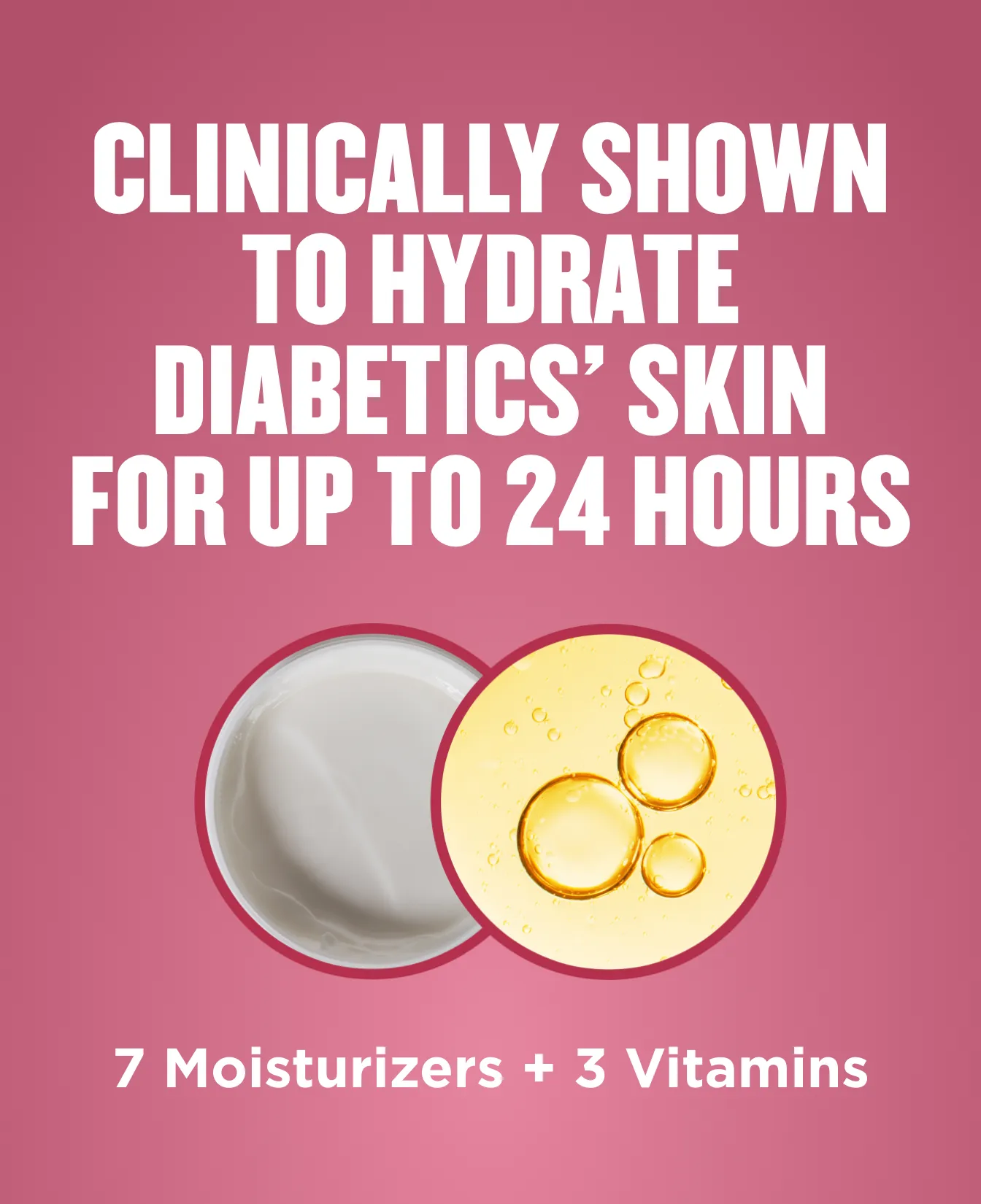 Packaging of Gold Bond® Diabetics' Dry Skin Relief Body Lotion and benefit statements.