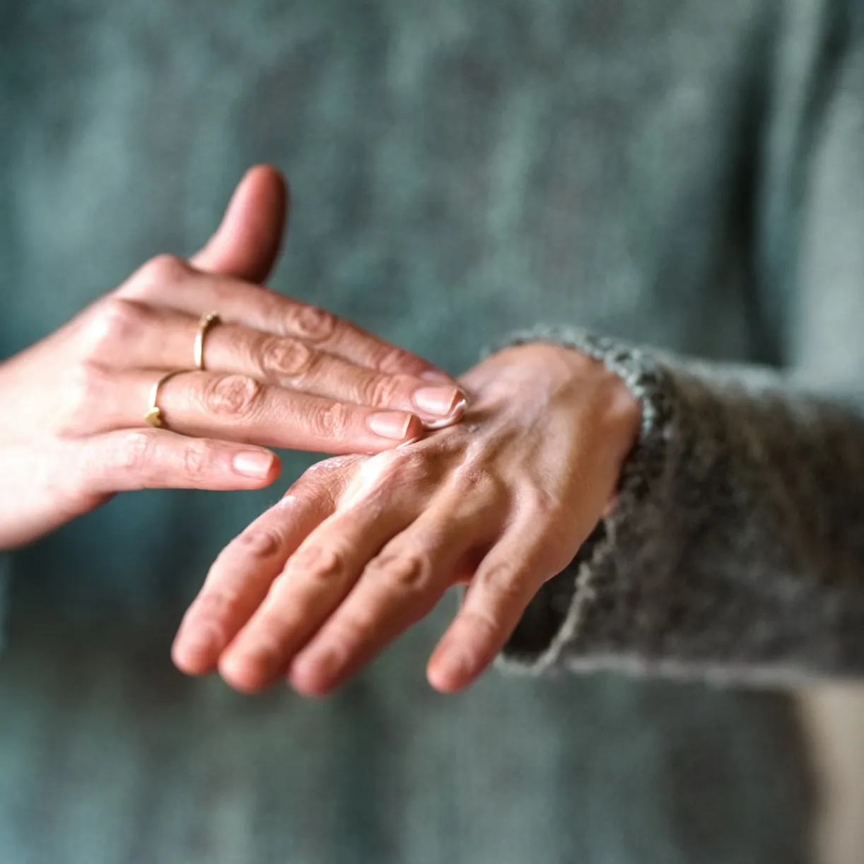 Close-up of a person's hands revealing symptoms indicative of eczema, a skin condition.