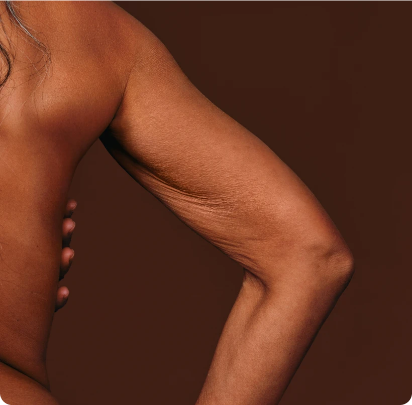 Close-up of a woman's arm featuring natural skin texture and lines. 