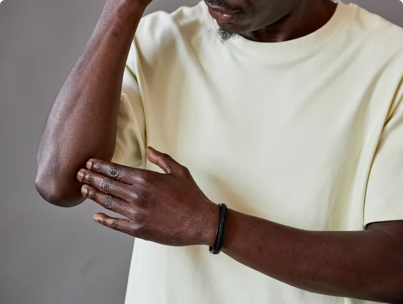 Close-up of a man's elbow revealing symptoms indicative of eczema, a skin condition.